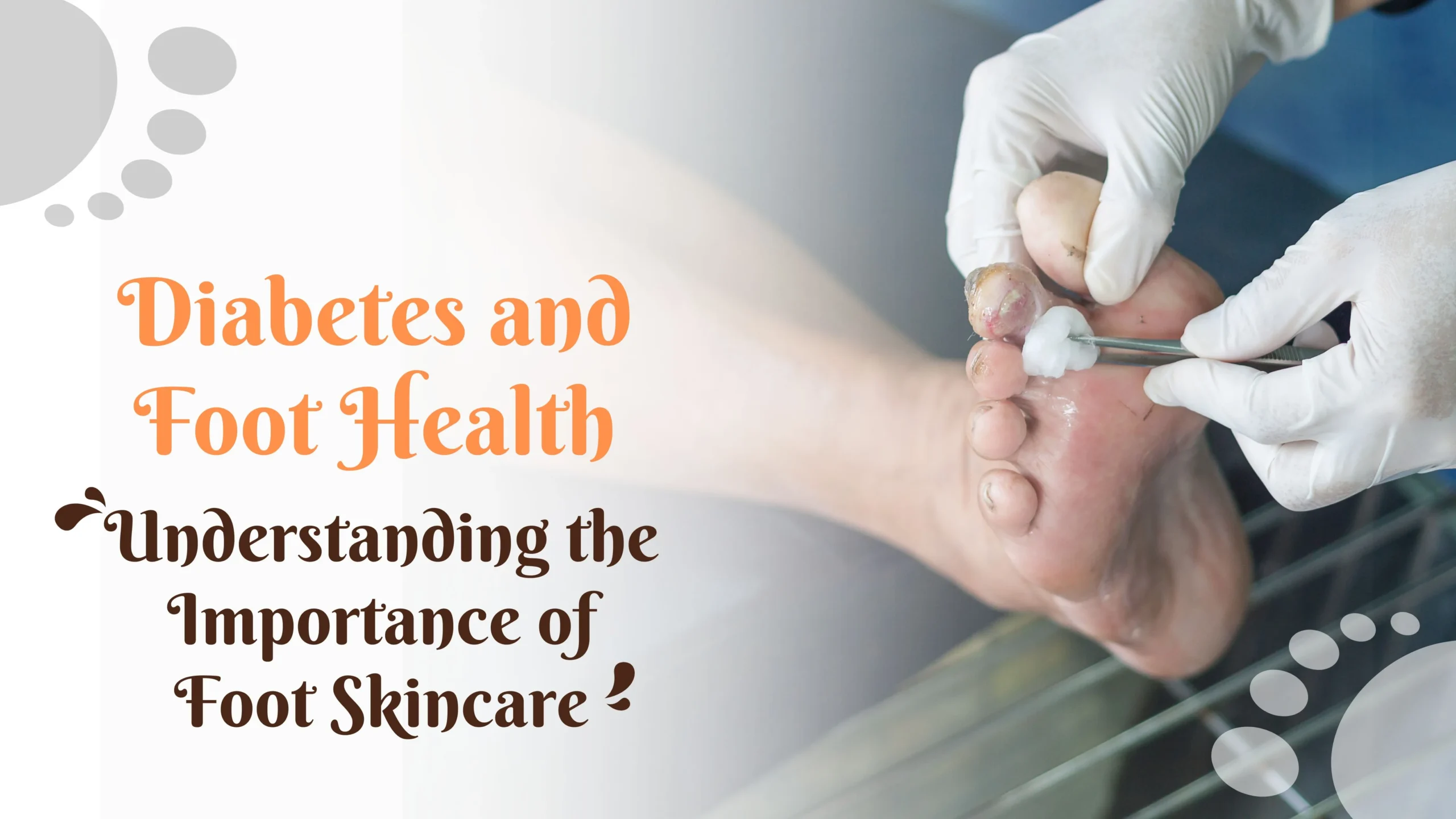 Importance of diabetic foot skincare